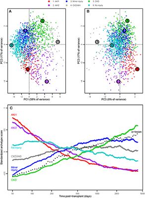 Archetypal Analysis of Injury in Kidney Transplant Biopsies Identifies Two Classes of Early AKI